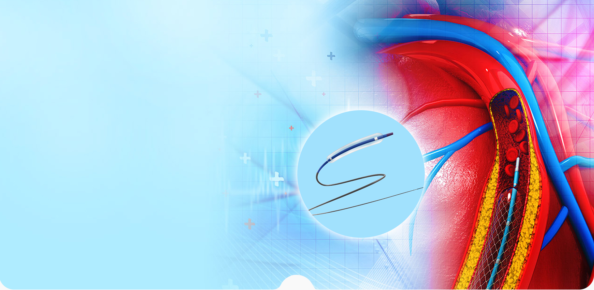 NINGBO LINSTANT POLYMER ÁBHAR ÁBHAR CO,. TEO.